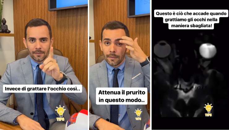 come non si deve grattare l'occhio